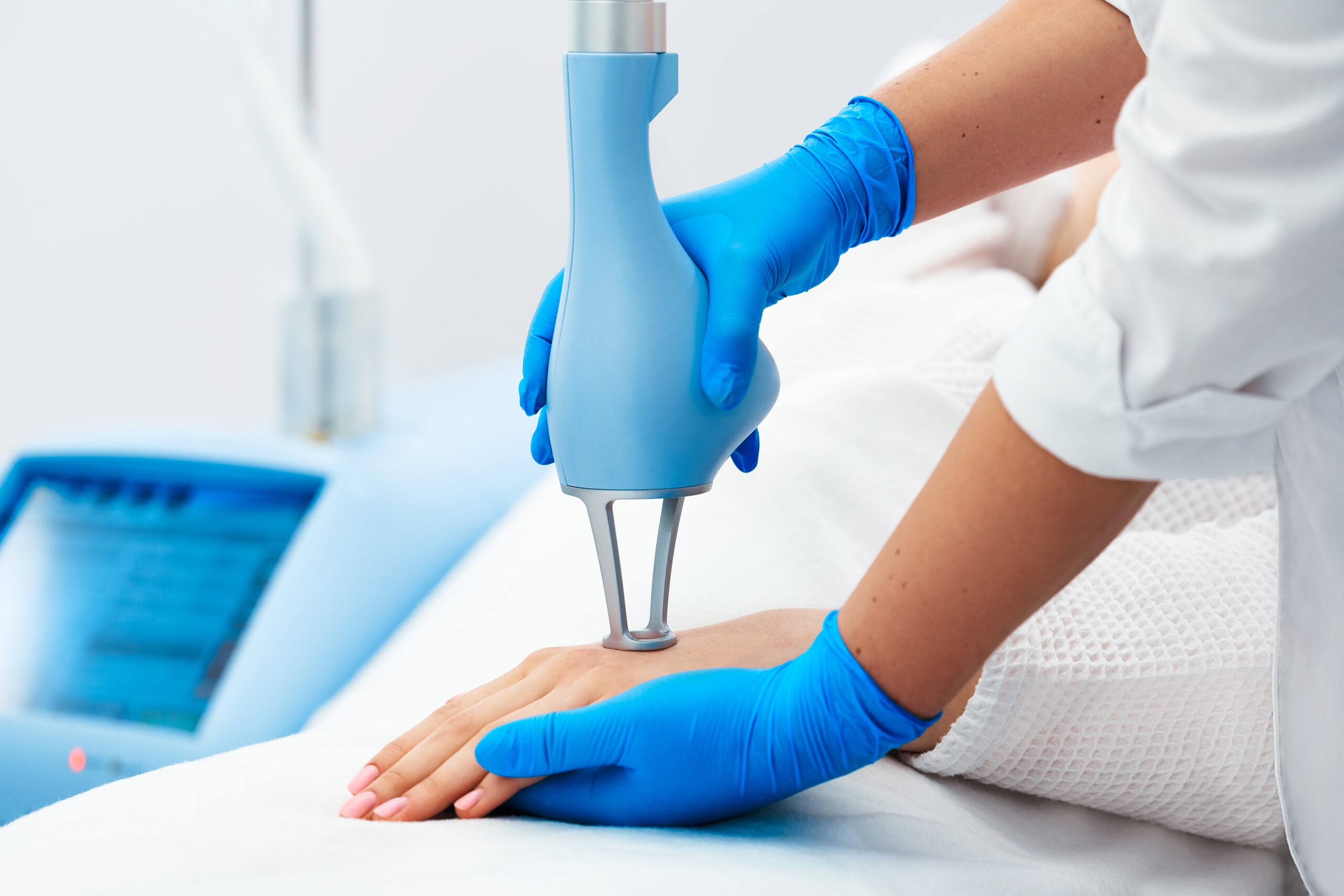Laser,Resurfacing,Treatments.,Cosmetologist,In,Blue,Glove,Holding,Laser,And